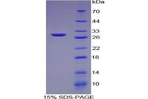 SDS-PAGE analysis of Human COL4a2 Protein. (COL4a2 蛋白)