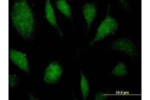 Immunofluorescence (IF) image for anti-Eukaryotic Translation Elongation Factor 1 delta (Guanine Nucleotide Exchange Protein) (EEF1D) (AA 1-91) antibody (ABIN515171)