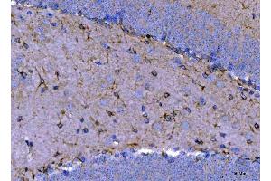 IHC analysis of Septin 2/SEPTIN2 using anti-Septin 2/SEPTIN2 antibody (ABIN7599275). (Septin 2 抗体  (AA 1-326))