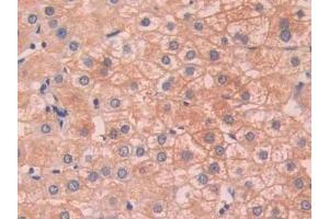Detection of SAP in Human Liver Tissue using Polyclonal Antibody to Serum Amyloid P Component (SAP) (APCS 抗体  (AA 23-223))
