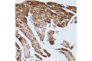 Immunohistochemistry (IHC) image for anti-ATPase, Ca++ Transporting, Cardiac Muscle, Slow Twitch 2 (ATP2A2) (AA 111-253) antibody (ABIN3021430)