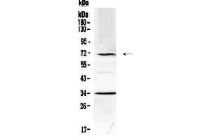 Western blot analysis of Alpha 1 Fetoprotein using anti-Alpha 1 Fetoprotein antibody . (alpha Fetoprotein 抗体  (AA 19-254))