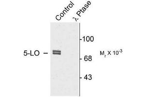 Image no. 1 for anti-Arachidonate 5-Lipoxygenase (ALOX5) (pSer523) antibody (ABIN372586) (ALOX5 抗体  (pSer523))