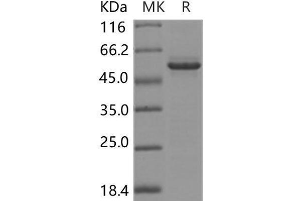 GFOD2 Protein (His tag)