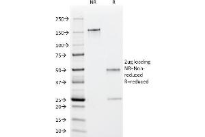 SDS-PAGE Analysis Purified EBV Mouse Monoclonal Antibody (1108-1). (EBV EA 抗体)