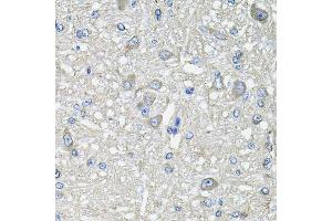Immunohistochemistry of paraffin-embedded rat brain using GFPT1 antibody. (GFPT1 抗体  (AA 1-150))