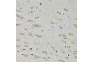 Immunohistochemistry (Paraffin-embedded Sections) (IHC (p)) image for anti-Ribosomal Protein L9 (RPL9) (AA 1-192) antibody (ABIN6147157)