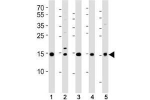 Western blot analysis of lysate from (1) 293T, (2) HeLa, (3) HL-60, (4) Jurkat cell lines and (5) rat liver tissue using SUMO2/3 antibody at 1:1000. (SUMO2/3 抗体  (AA 49-81))