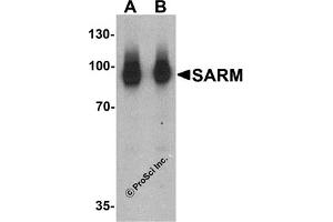 Western Blotting (WB) image for anti-Sterile alpha and TIR Motif Containing 1 (SARM1) (N-Term) antibody (ABIN1031550) (SARM1 抗体  (N-Term))