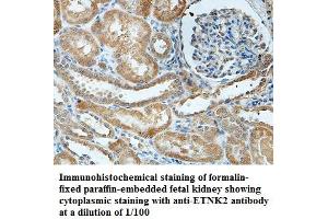 Image no. 1 for anti-Ethanolamine Kinase 2 (ETNK2) antibody (ABIN1576385) (Ethanolamine Kinase 2 抗体)