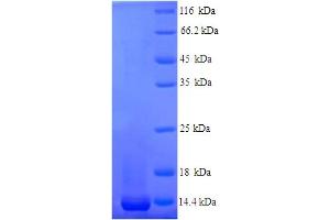 SDS-PAGE (SDS) image for Nogo B Receptor (NUS1) (AA 24-120) protein (His tag) (ABIN5714458)