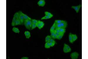 Immunofluorescence staining of HepG2 cells with ABIN7151530 at 1:166, counter-stained with DAPI. (ELMOD3 抗体  (AA 1-102))