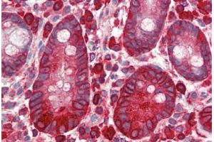 Human Small Intestine (formalin-fixed, paraffin-embedded) stained with EEF2 antibody ABIN334266 at 1:100 followed by biotinylated goat anti-rabbit IgG secondary antibody ABIN481713, alkaline phosphatase-streptavidin and chromogen. (EEF2 抗体  (pThr56))