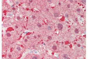 Rabbit Anti-ALDOB antibody  Formalin Fixed Paraffin Embedded Tissue: Human Liver Primary antibody Concentration: 1:100 Secondary Antibody: Donkey anti-Rabbit-Cy3 Secondary Antibody Concentration: 1:200 Magnification: 20x Exposure Time: 0. (ALDOB 抗体  (N-Term))