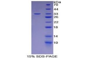 SDS-PAGE analysis of Mouse LCP2 Protein. (LCP2 蛋白)