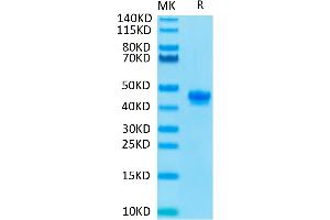 SDS-PAGE (SDS) image for Poliovirus Receptor-Related 4 (PVRL4) (AA 31-347) protein (His tag) (ABIN7275318)