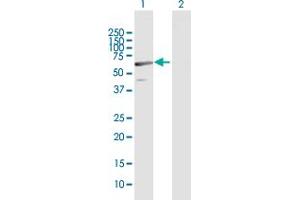 Western Blot analysis of C1orf87 expression in transfected 293T cell line by C1orf87 MaxPab polyclonal antibody. (C1orf87 抗体  (AA 1-546))