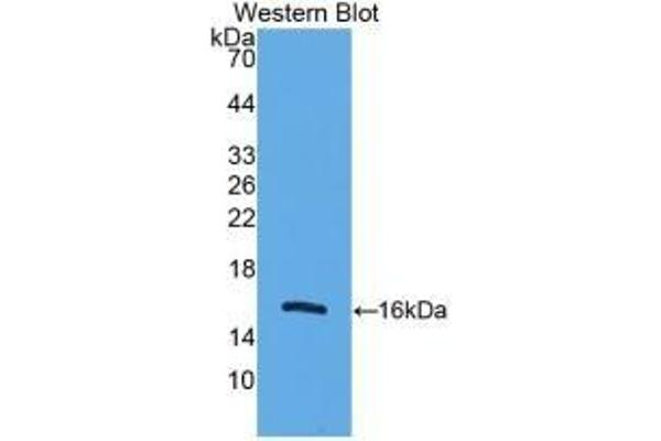 UCP2 anticorps  (AA 154-289)
