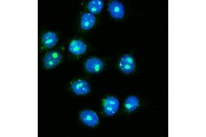 IF analysis of NOLA1/GAR1 using anti-NOLA1/GAR1 antibody (ABIN7602076).