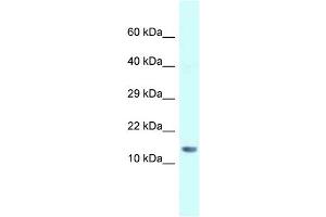 WB Suggested Anti-Gm14277 Antibody   Titration: 1. (Gm14277 抗体  (N-Term))