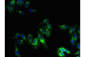 Immunofluorescent analysis of Hela cells using ABIN7149255 at dilution of 1:100 and Alexa Fluor 488-congugated AffiniPure Goat Anti-Rabbit IgG(H+L) (CYP2U1 抗体  (AA 363-496))