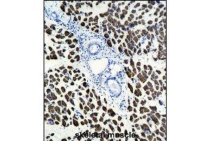 ACTA1 Antibody (ABIN1536597 and ABIN2843809) immunohistochemistry analysis in formalin fixed and paraffin embedded human skeletal muscle followed by peroxidase conjμgation of the secondary antibody and DAB staining. (Actin 抗体)