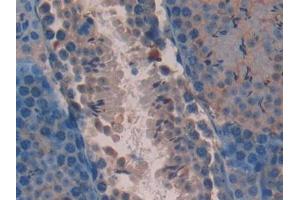 DAB staining on IHC-P; Samples: Mouse Testis Tissue (AATK 抗体  (AA 137-386))