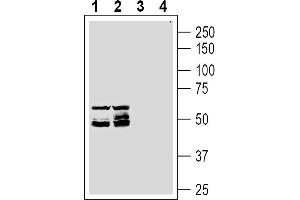 Western blot analysis of rat (lanes 1 and 3) and mouse (lanes 2 and 4) testis membranes:1-2.
