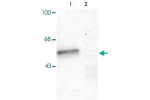 Western blot of mouse forebrain lysates from Wild Type (Control, lane 1) and Gabra1 knockout (Gabra1-K/O, lane 2) animals showing specific immunolabeling of the ~51 alpha1-subunit of the Gabra1. (GABRA1 抗体  (N-Term))