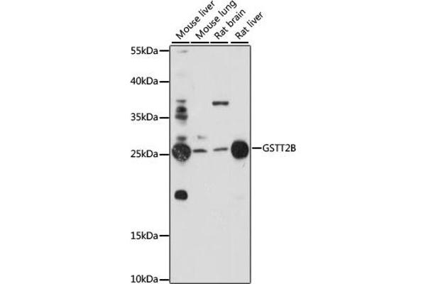 GSTT2B 抗体  (AA 115-244)