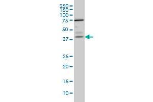 Western Blotting (WB) image for anti-Paraneoplastic Antigen MA1 (PNMA1) (AA 62-161) antibody (ABIN598600) (PNMA1 抗体  (AA 62-161))