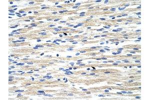 CBX6 antibody was used for immunohistochemistry at a concentration of 4-8 ug/ml to stain Skeletal muscle cells (arrows) in Human Muscle. (CBX6 抗体  (N-Term))