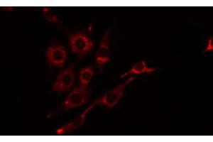 ABIN6274815 staining Hela by IF/ICC. (BST1 抗体  (Internal Region))