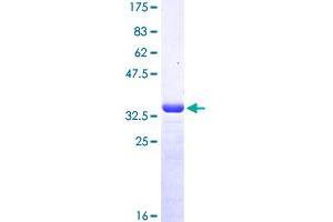 MSRB2 Protein (AA 102-201) (GST tag)