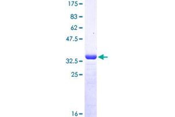 MSRB2 Protein (AA 102-201) (GST tag)