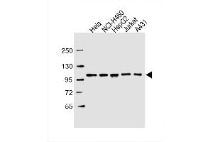 Western Blot at 1:2000 dilution Lane 1: Hela whole cell lysate Lane 2: NCI-H460 whole cell lysate Lane 3: HepG2 whole cell lysate Lane 4: Jurkat whole cell lysate Lane 5: A431 whole cell lysate Lysates/proteins at 20 ug per lane.