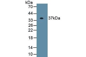 Detection of Recombinant EXOSC2, Human using Polyclonal Antibody to Exosome Component 2 (EXOSC2) (EXOSC2 抗体  (AA 1-293))