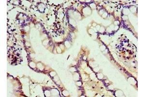 Immunohistochemistry of paraffin-embedded human small intestine tissue using ABIN7150217 at dilution of 1:100 (ALKBH2 抗体  (AA 1-261))