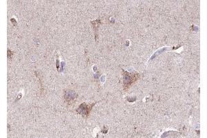 ABIN6267418 at 1/100 staining human brain tissue sections by IHC-P. (GABA-RB (pSer434) 抗体)