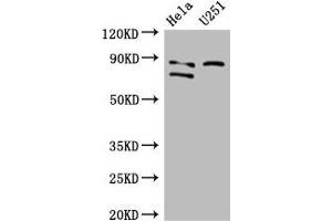 Western Blot Positive WB detected in: Hela whole cell lysate, U251 whole cell lysate All lanes: FCHO2 antibody at 3 μg/mL Secondary Goat polyclonal to rabbit IgG at 1/50000 dilution Predicted band size: 89, 44, 86 kDa Observed band size: 89, 86 kDa (FCHO2 抗体  (AA 100-203))