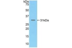 Detection of Recombinant MAdCAM1, Mouse using Polyclonal Antibody to Mucosal Addressin Cell Adhesion Molecule 1 (MAdCAM1) (MADCAM1 抗体  (AA 29-297))