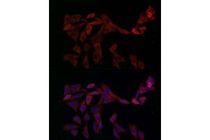 Immunofluorescence analysis of PC-12 cells using OP antibody (ABIN6129426, ABIN6145031, ABIN6145032 and ABIN6225150) at dilution of 1:100 (40x lens). (OPA1 抗体  (AA 661-960))