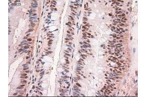 Image no. 1 for anti-Myc Proto-Oncogene protein (MYC) antibody (ABIN1497012) (c-MYC 抗体)