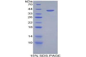 SDS-PAGE analysis of Human Hemojuvelin Protein. (HFE2 蛋白)
