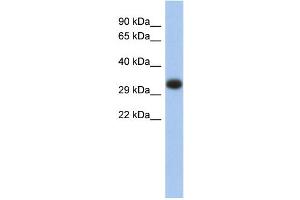 Western Blotting (WB) image for anti-Major Histocompatibility Complex, Class II, DP alpha 1 (HLA-DPA1) (Middle Region) antibody (ABIN2784090)