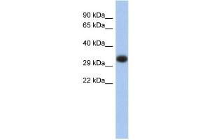 WB Suggested Anti-HLA-DPA1 Antibody Titration:  0.