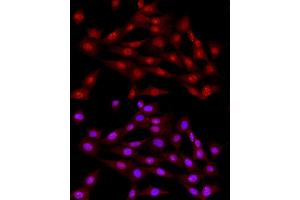 Immunofluorescence (IF) image for anti-Ligase III, DNA, ATP-Dependent (LIG3) (AA 730-1009) antibody (ABIN6143207)