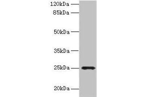 Western blot All lanes: FGFBP2 antibody at 2 μg/mL + Human serum Secondary Goat polyclonal to rabbit IgG at 1/10000 dilution Predicted band size: 25 kDa Observed band size: 25 kDa (FGFBP2 抗体  (AA 20-223))