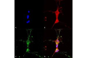 Immunocytochemistry/Immunofluorescence analysis using Mouse Anti-TrpC7 Monoclonal Antibody, Clone N64A/36 (ABIN2485419). (TRPC7 抗体  (AA 845-862) (Atto 390))