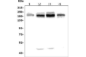 Western blot analysis of UBR2 using anti-UBR2 antibody (ABIN7599609).